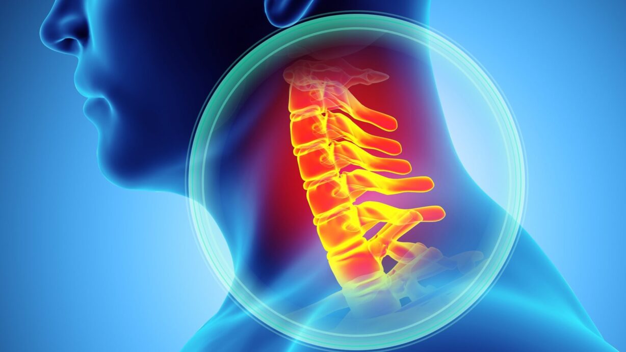 Stellate Ganglion Block Treatment for PTSD
